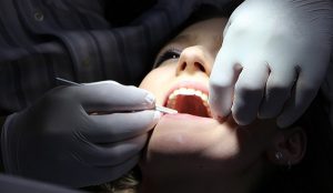 ضرورت کشیدن دندان در ارتودنسی